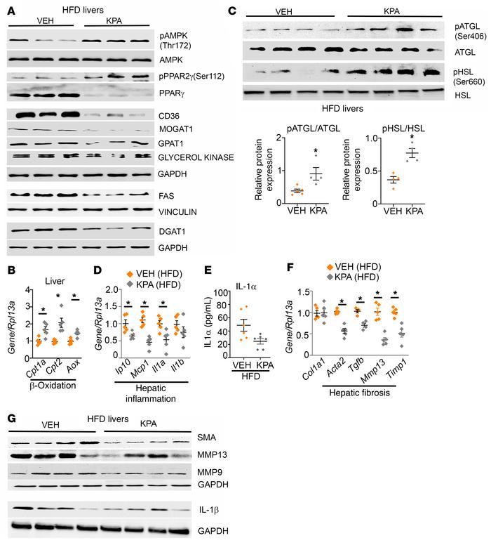 Kisspeptin analog treatment decreases markers of lipogenesis, inflammati...