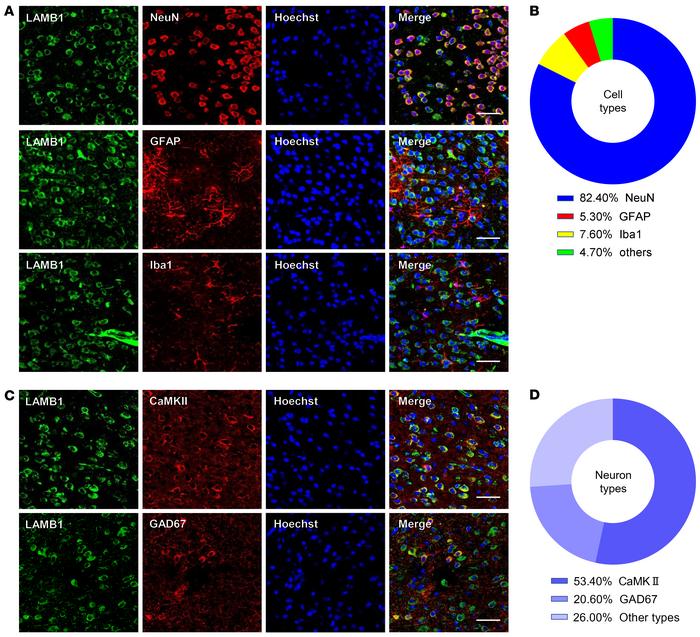 Characterization of expression profile of LAMB1 in the ACC.
(A and B) Re...