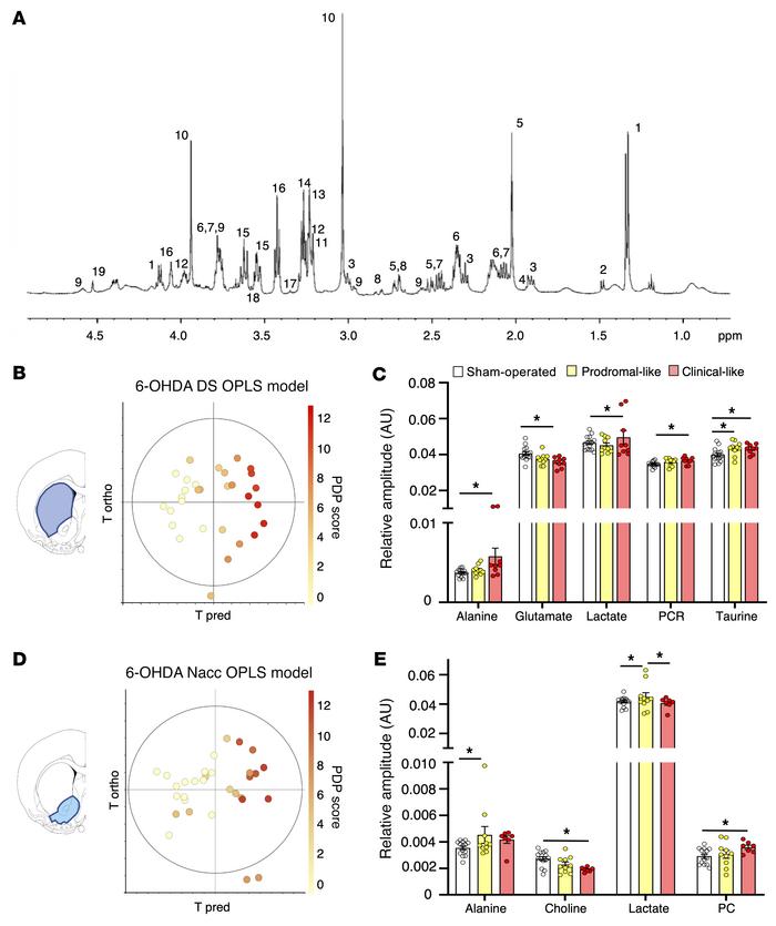 Brain metabolic profile of 6-OHDA rats is gradually modified during PD p...