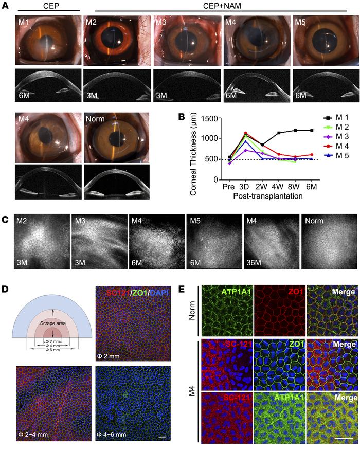 Therapeutic effect of hESC-derived CEPs with NAM treatment for corneal r...