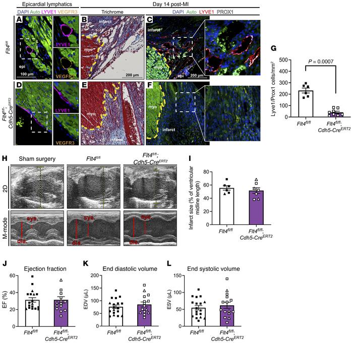 Pan-endothelial deletion of Flt4 severely reduces lymphangiogenesis in t...