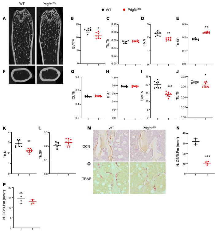 Conditional Pdgfb transgenic mice recapitulate an aging-associated bone ...