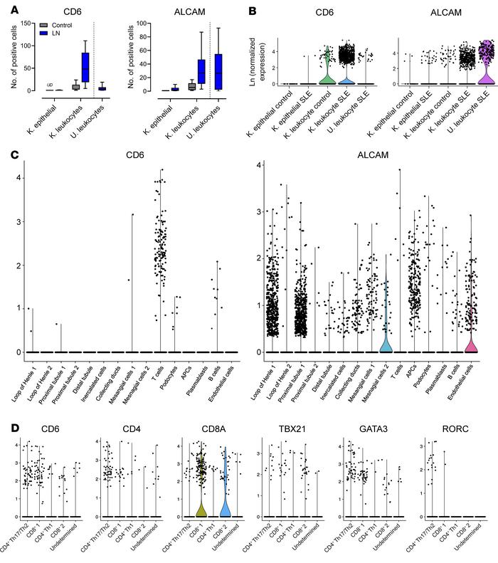 CD6 and ALCAM are overexpressed in renal tissue of patients with LN.
A s...