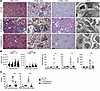 Parasite infection prevents severe kidney injury but does not reduce glomer