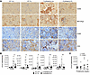 Parasite infection impairs T cell and monocyte infiltration in kidney.