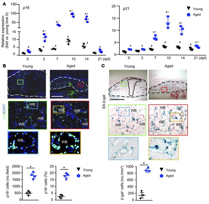 Increase in p16+ SCs in fracture callus of aged mice.
Young and aged mic...