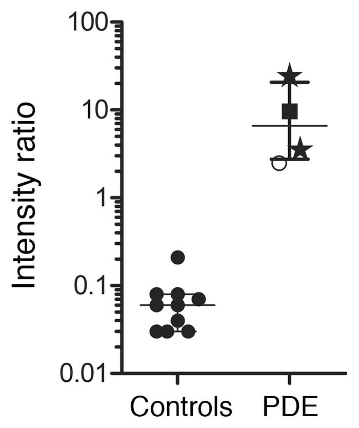 2-OPP–based diagnosis of PDE-ALDH7A1 in DBS using a direct-infusion MS m...