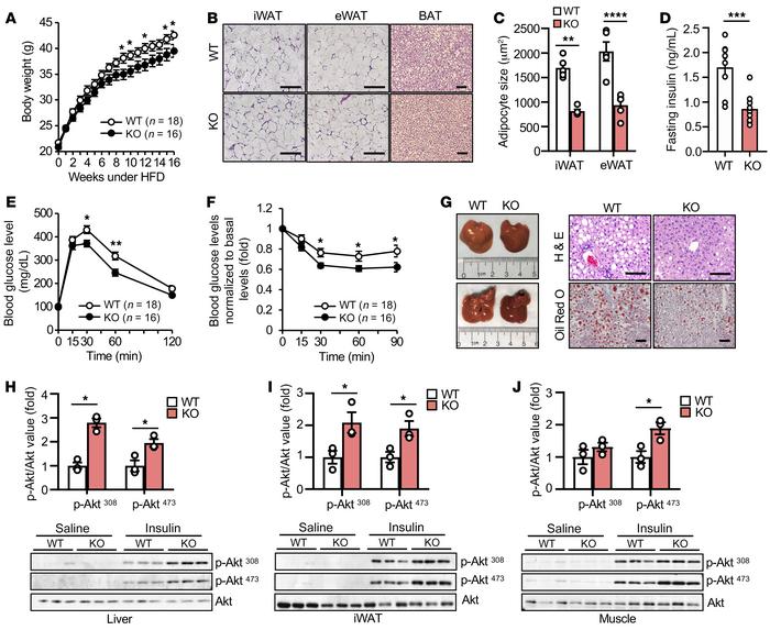 
Lrg1 knockout protects mice from diet-induced hepatic steatosis and ins...