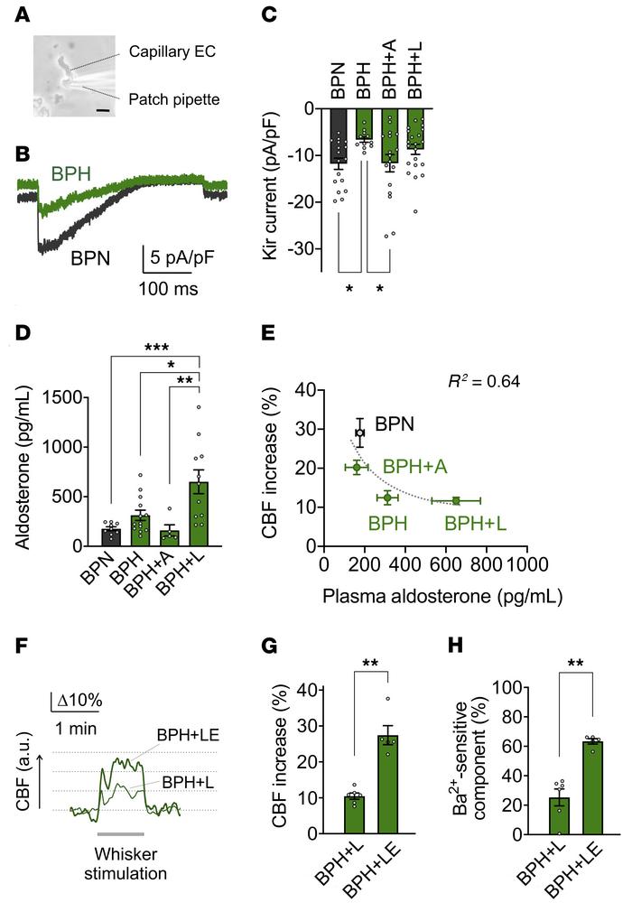 Capillary EC Kir2.1 channel downregulation underlies deficits in capilla...