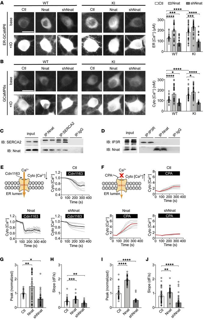 Nnat increases ER calcium storage by facilitating SERCA function.
(A and...