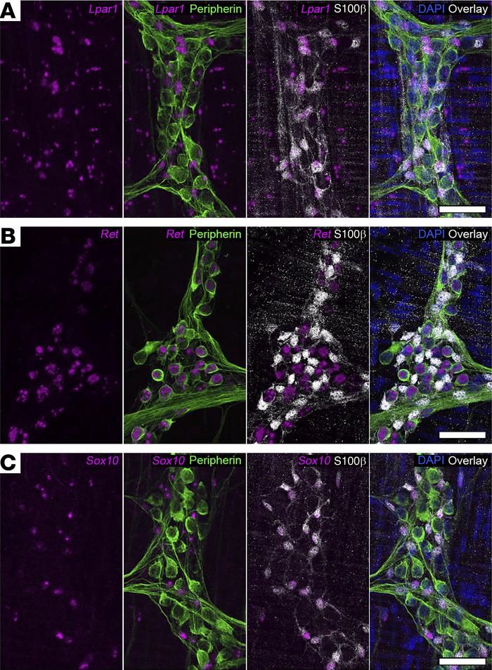 Distribution of Lpar1 mRNA in the mouse colon myenteric plexus.
(A) Comb...