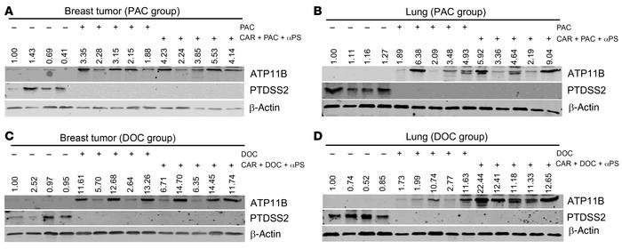 Reversal of ATP11B and PTDSS2 by combinatory treatment at protein level....