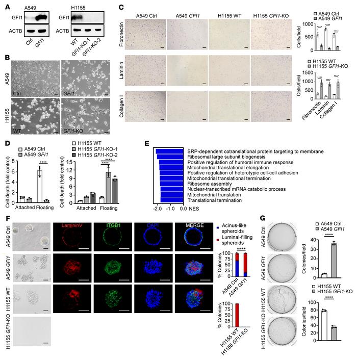 GFI1 promotes cell detachment and anchorage independence.
(A) Immunoblot...