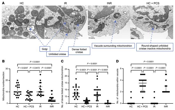 Treatment of memory CD4+ T cells with PCS reduces mitochondrial fitness....