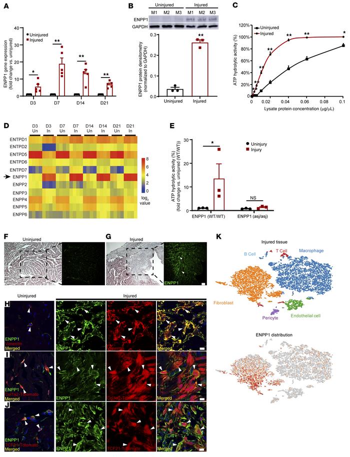 ENPP1 is expressed in the infarcted heart by nonmyocytes and is the prin...