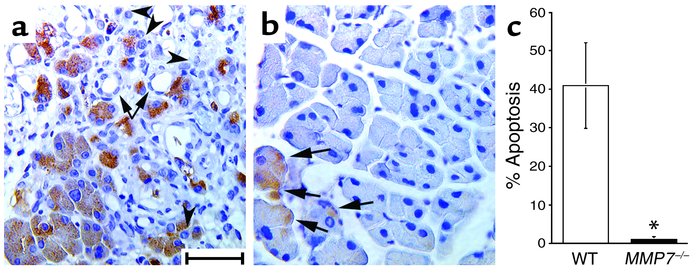 Inhibition of acinar cell apoptosis following duct ligation in MMP7–/– m...