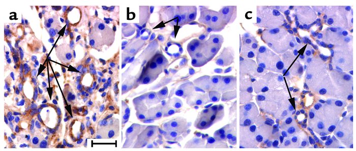 Bcl-2 expression in wild-type, MMP7–/–, and gld pancreata. Immunohistoch...