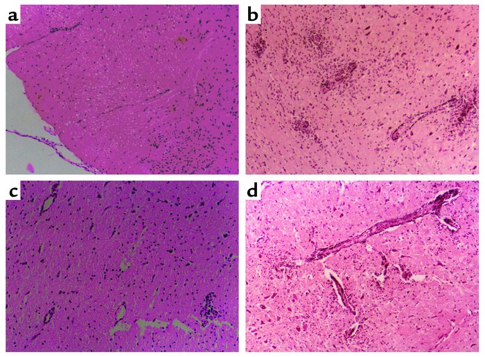 (a–d) Thirteen days after immunization with MBPp87–99/CFA to induce acti...