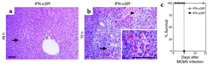 Effects of IFN-α/β on susceptibility to MCMV. Livers were harvested and ...