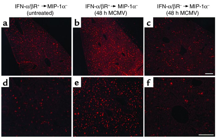 Characterization of IFN-α/β–mediated leukocyte trafficking to livers. Bo...