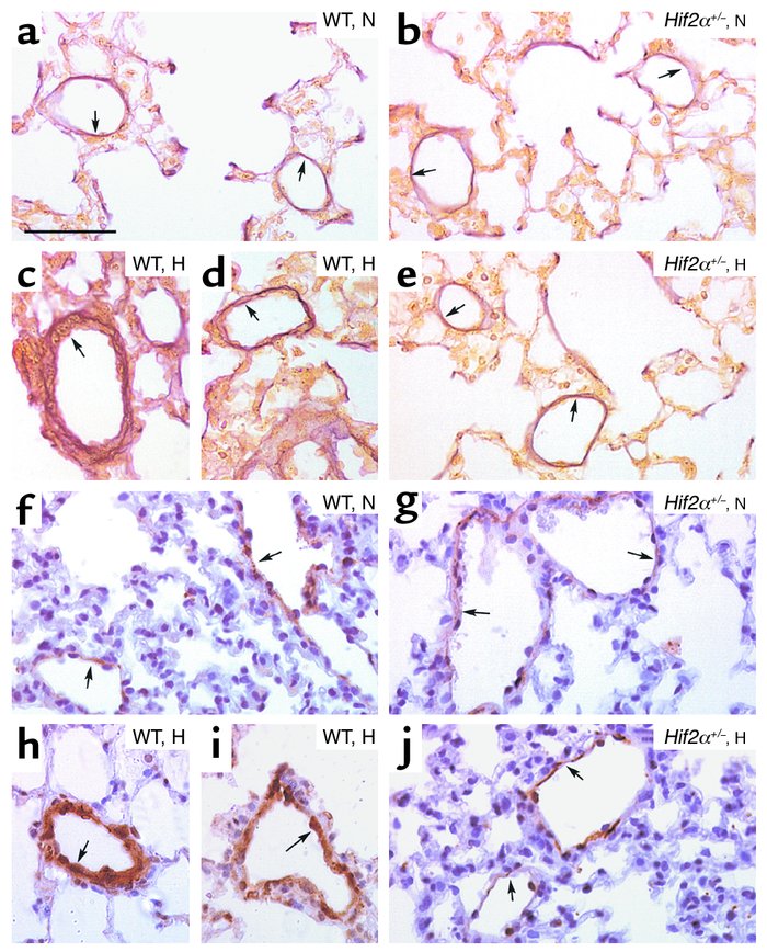 (a–e) Hart’s elastin staining revealed the presence of vessels, located ...