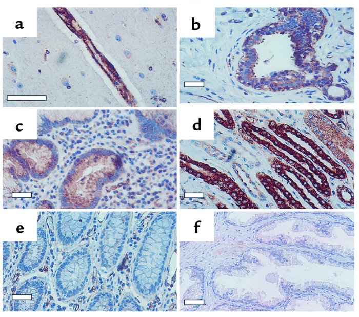 Expression of HIP1 in normal human tissues. (a) Endothelium of a cortica...