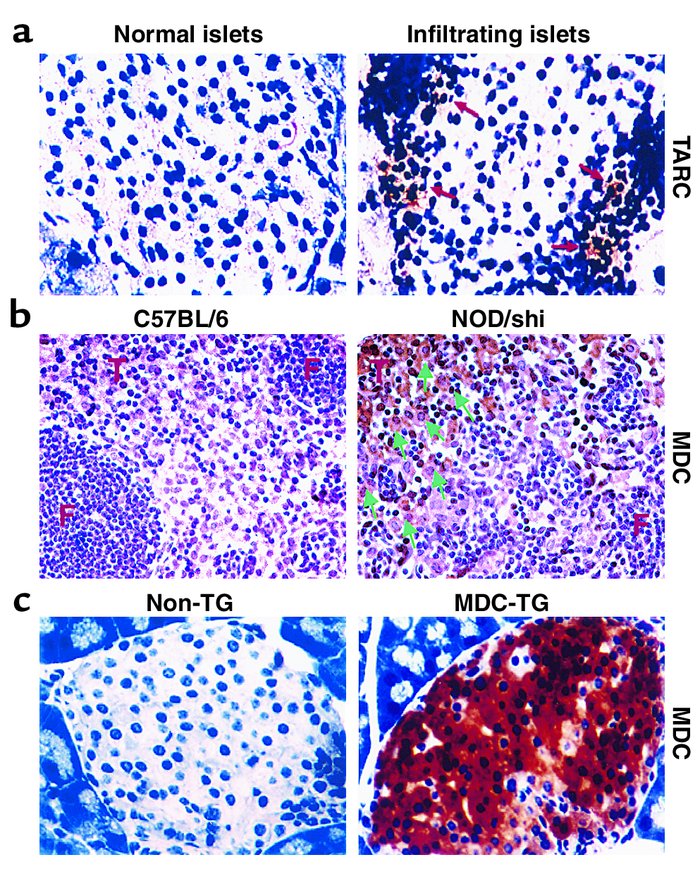 TARC and MDC expression in pancreatic islets and lymph nodes of prediabe...