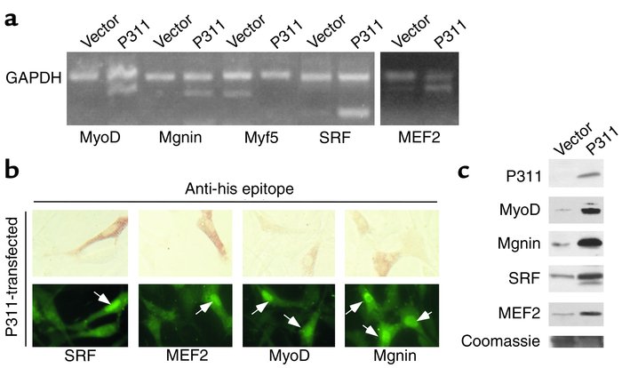 Transfection of P311 into NIH-3T3 cells stimulates muscle-specific trans...