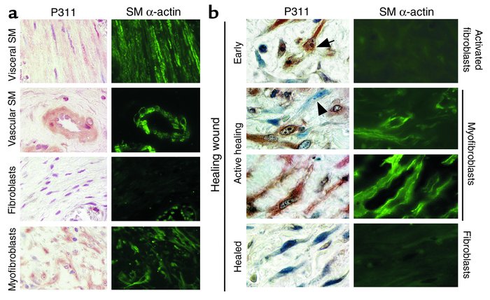 P311 is expressed in human visceral and vascular SM cells and myofibrobl...