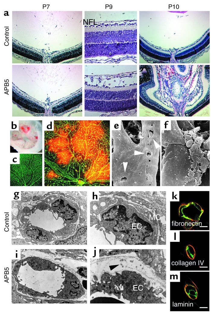 Deteriorated integrity of retinal vessels in the absence of MCs. (a) H&a...