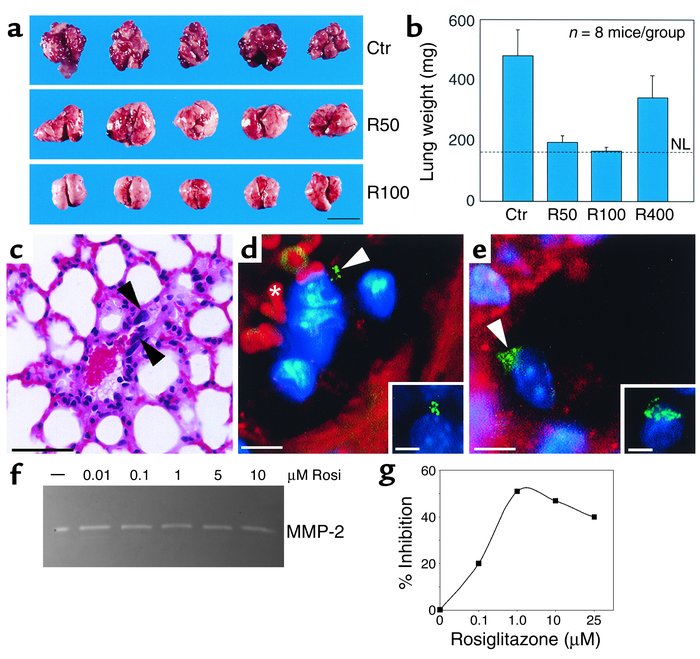 Systemic therapy with PPARγ ligands prevents metastatic invasion after r...