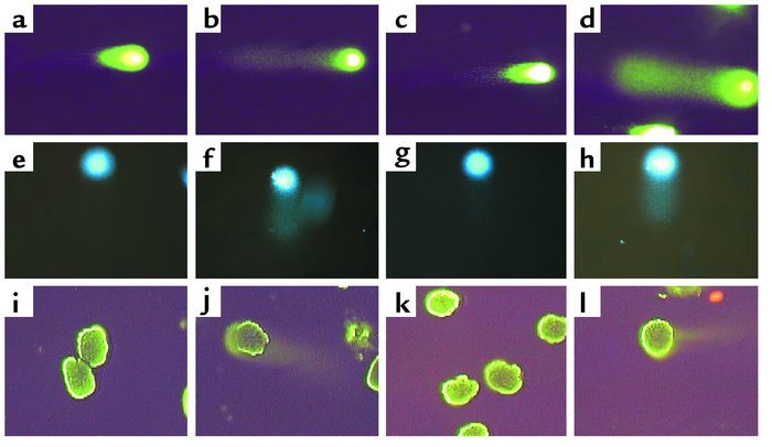 Comet assay. DNA damage was measured in rat (a–d) and mouse (e–h) podocy...