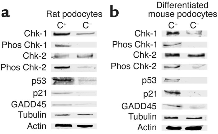 Sublytic C5b-9 increases CHK-1, CHK-2, p53, p21, and GADD45 expression i...