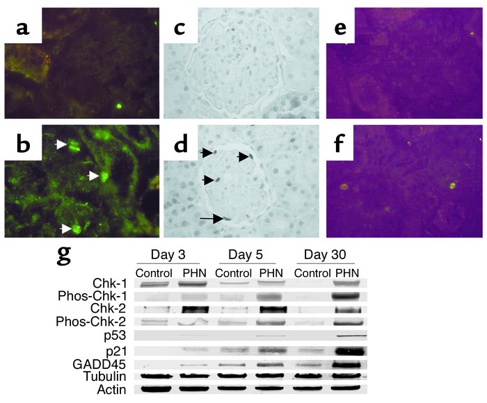 DNA damage proteins increase in PHN rats. Immunostaining for p53 (a), p2...