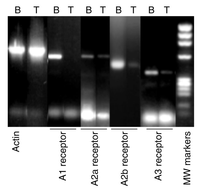 Adenosine receptor expression in murine fetal thymocytes. Adenosine rece...