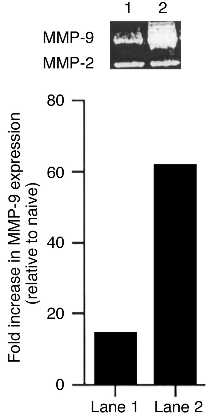 Neutrophil depletion markedly diminishes MMP-9 production. Groups of mic...