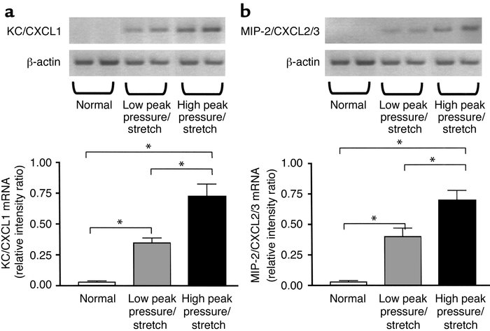 KC/CXCL1 and MIP-2/CXCL2/3 mRNA levels are markedly elevated during VILI...