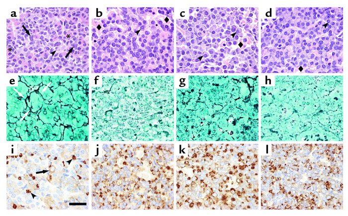 Histological analysis of anterior pituitaries from 14-month-old female m...