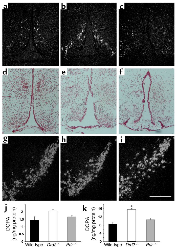TH expression and activity. (a–i) In situ hybridization for TH mRNA; dar...