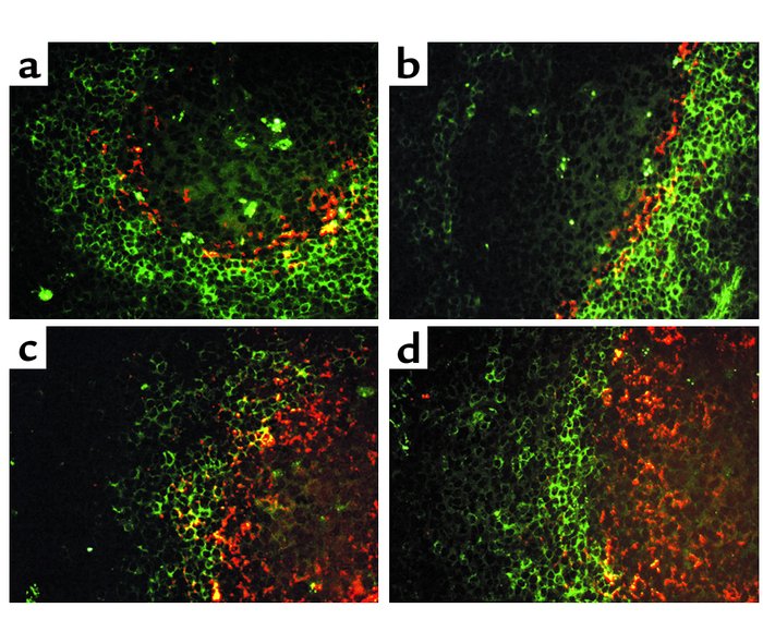 Location of PAP-positive cells in untreated animals compared with animal...