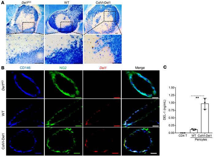 DEL-1 is expressed in the inguinal LNs by pericytes.
(A) Inguinal LNs fr...