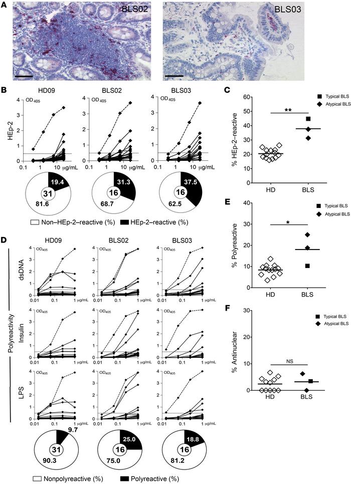 Patients with B cell-selective MHC Class II deficiency harbor elevated p...