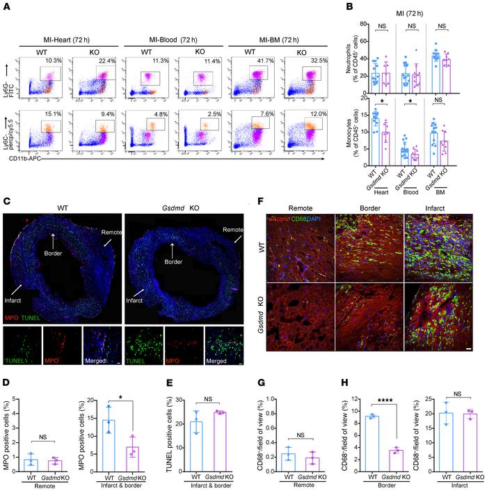 GSDMD is essential for recruitment of neutrophils/monocytes to the infar...