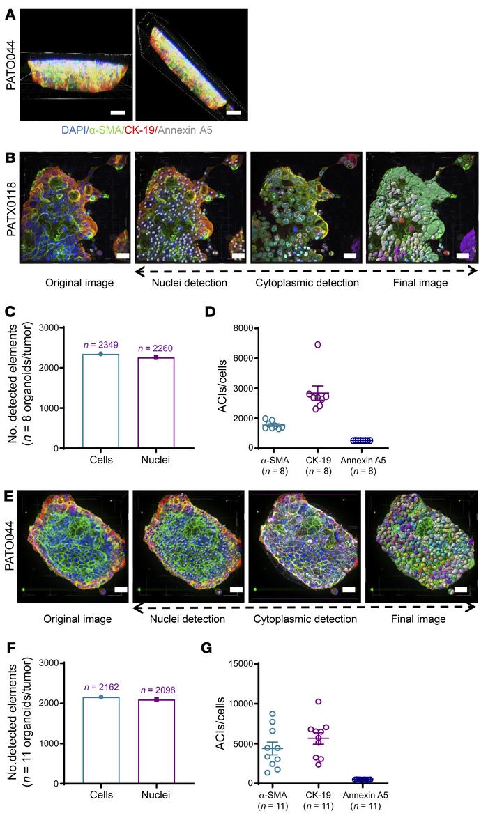 Construction and quantification of 3D cytoplasmic and nuclear algorithms...