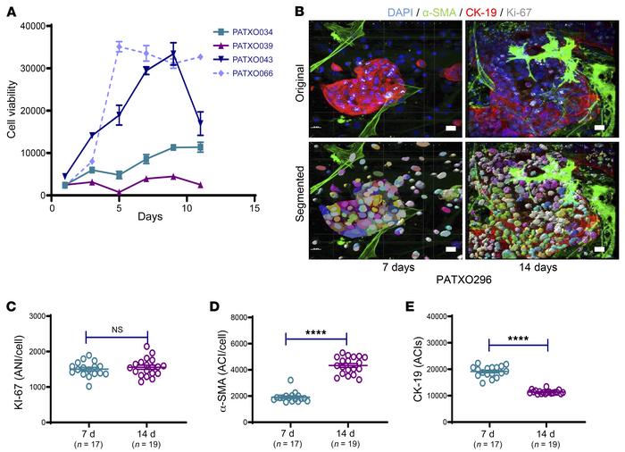 Patient-derived xenograft organoid growth curves and quantification of A...