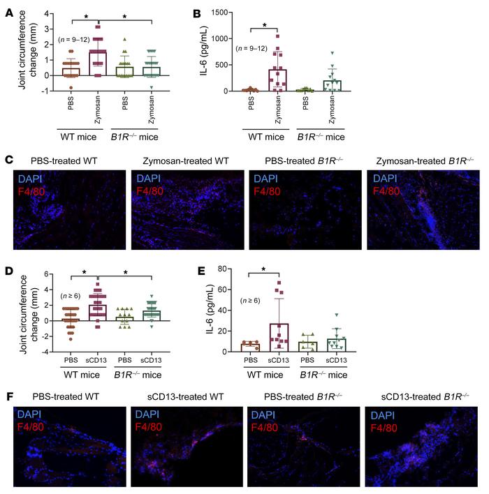 
B1R–/– mice are resistant to zymosan- or sCD13-induced arthritis.
(A) W...