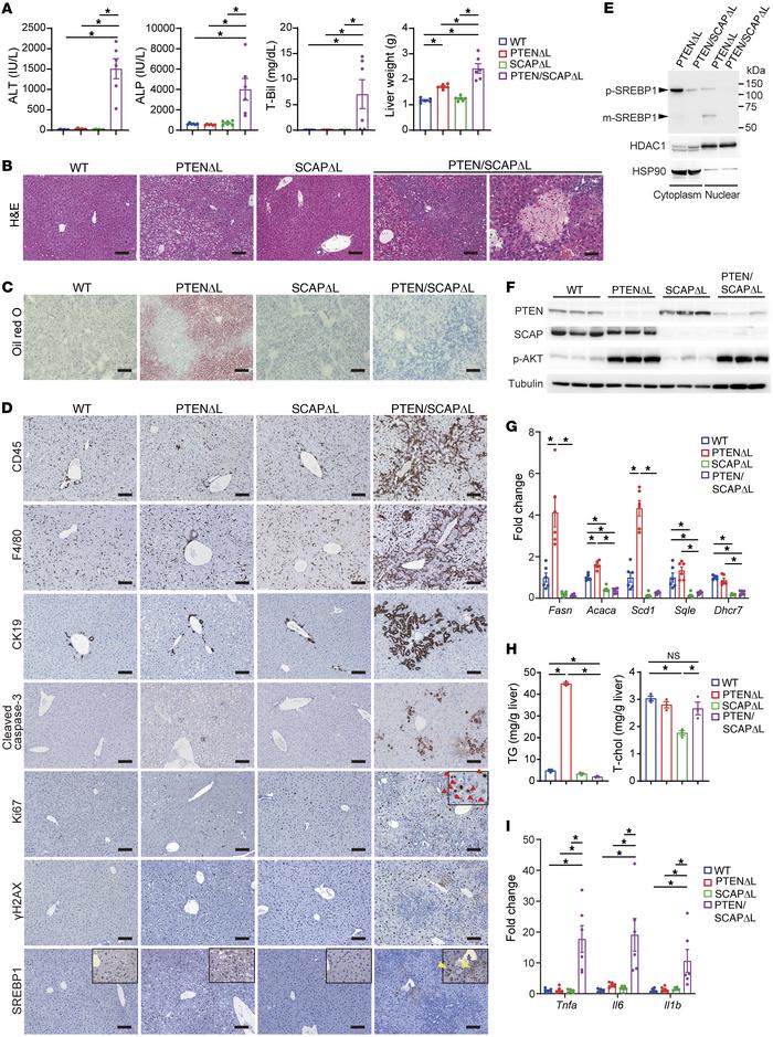 Liver-specific PTEN/SCAP double-knockout mice exhibit severe liver injur...