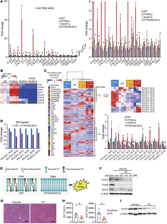 Comprehensive lipidomic analyses identified altered phospholipid composi...