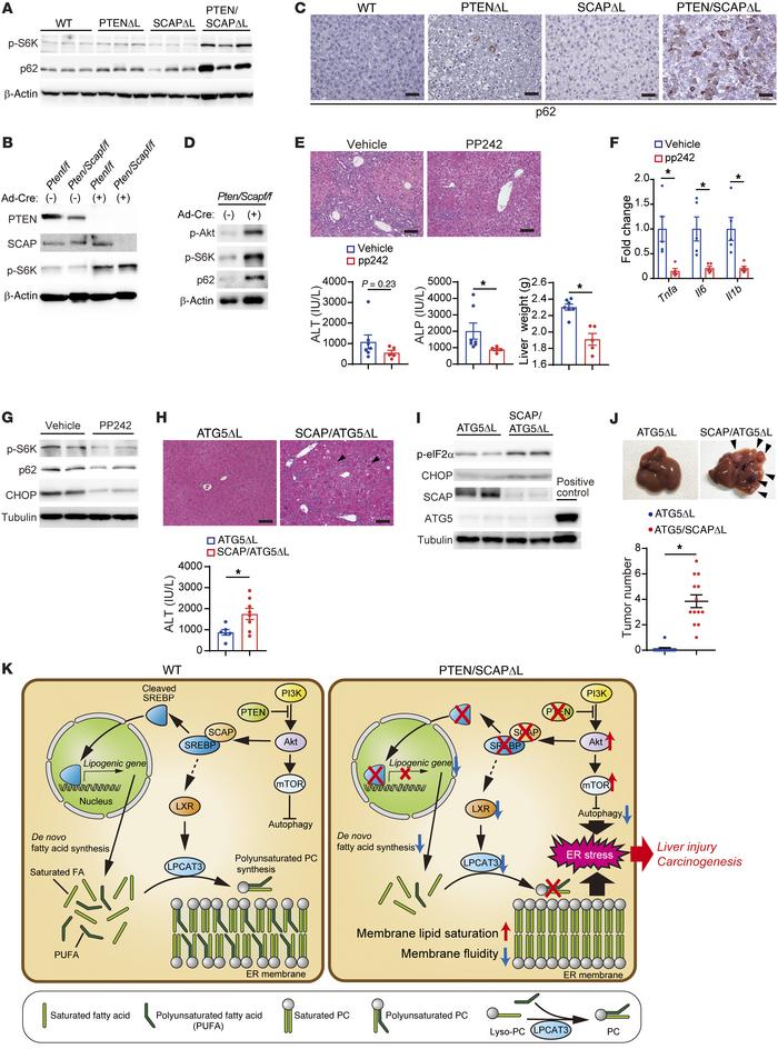 Deletion of SCAP cooperated with mTOR activation to trigger liver injury...