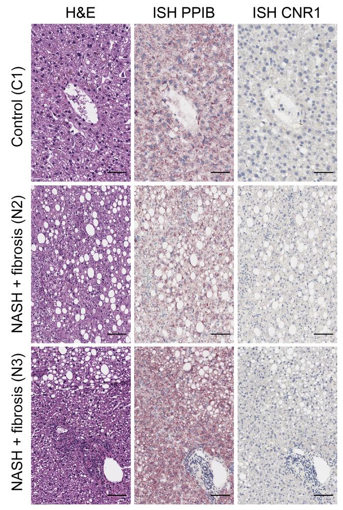 
CNR1 mRNA expression in control and NASH human livers.
Left panel: Repr...